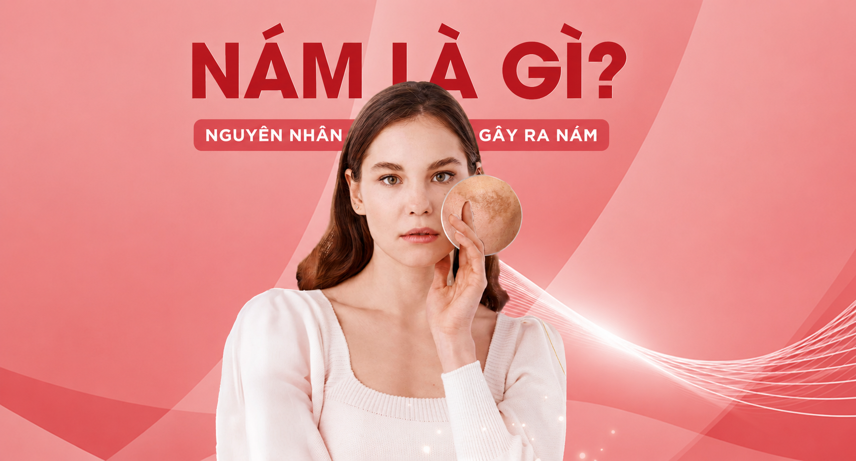 Nám Da Là Gì: Nguyên Nhân Gây Nám Da Cần Biết