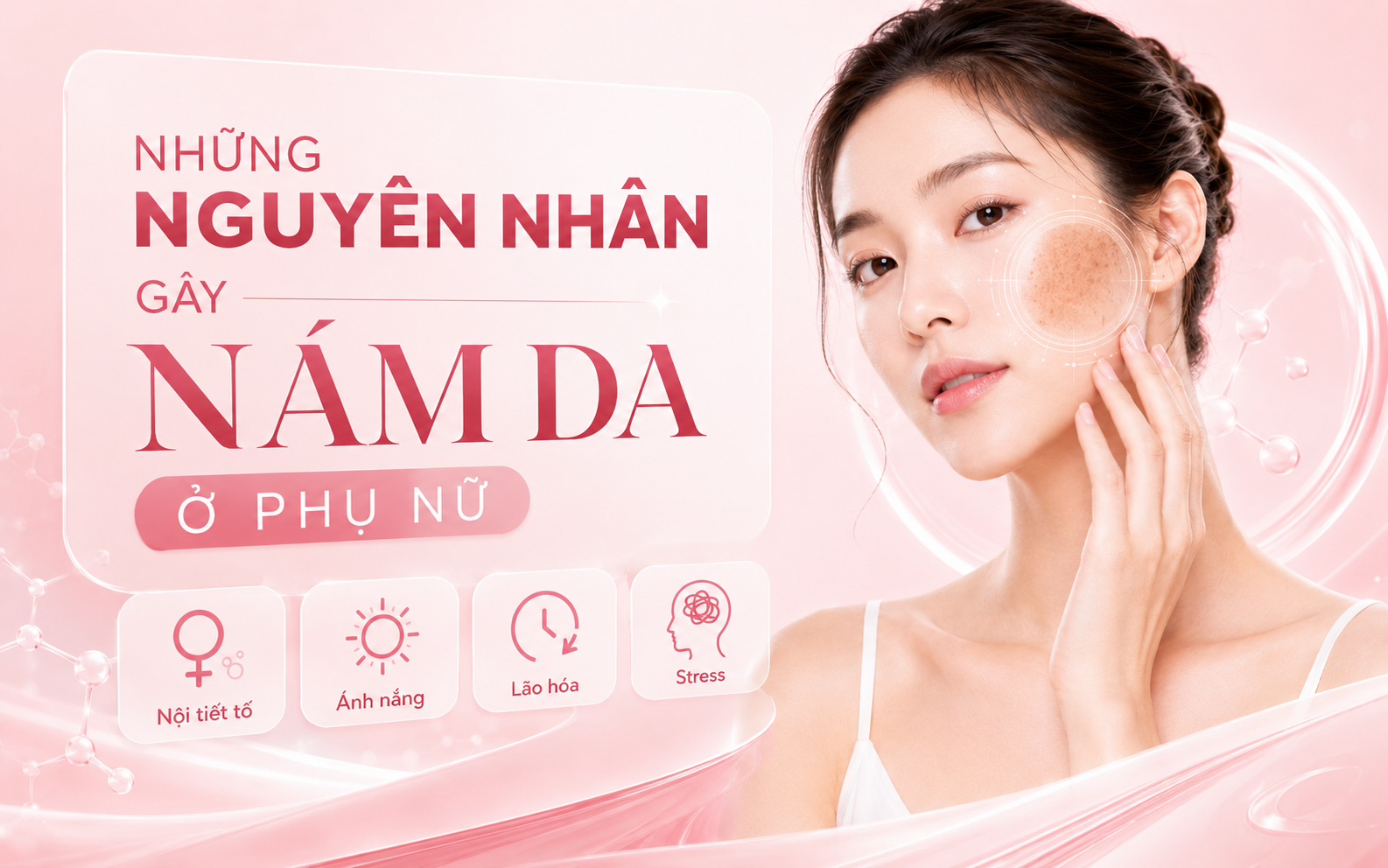 Nguyên Nhân Gây Nám Da Ở Phụ Nữ Và Cách Phòng Ngừa Hiệu Quả